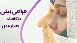 جراحی بینی