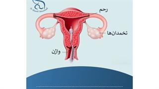 کاربرد عکس رنگی از رحم
