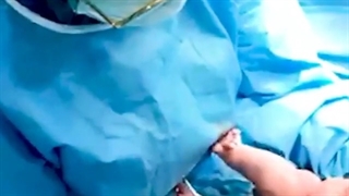 فیلم زایمان سزارین در اتاق عمل