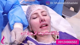 عمل سانترال لب