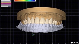 راه های زیادی برای زیبا تر کردن لبخند شما وجود دارد | دکتر لیلا عطایی