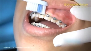 روش صحیح مسواک زدن | دکتر سپیده دادگر