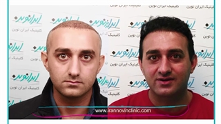 رضایت مشتری