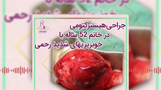 جراحی هیسترکتومی در خانم ۵۲ ساله با خونریزیهای شدید رحمی