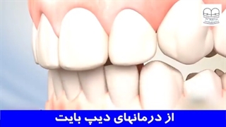 از درمان های دیپ بایت | دکتر احسان مهریزی