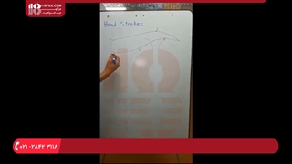 تتوی صورت - میکروبلیدینگ خطوط سر