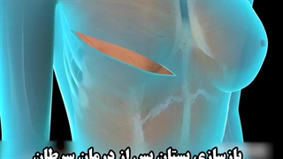انیمیشن نحوه بازسازی پستان پس از درمان سرطان | دکتر هادیزاده | جراح سینه