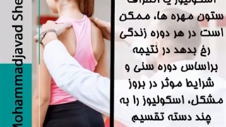 با انواع اسکولیوز یا انحراف ستون فقرات آشنا شویم
