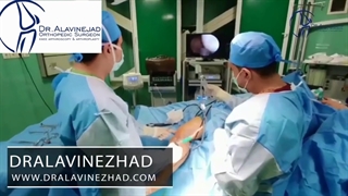 بازسازی رباط صلیبی قدامی