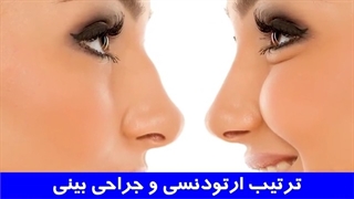 ترتیب ارتودنسی و جراحی بینی | دکتر احسان مهریزی