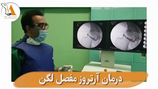 آرتروز مفصل لگن