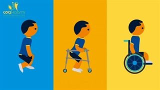 انیمیشن عوارض راه رفتن با زانوی خمیده