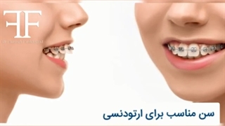 سن ارتودنسی دندان