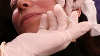 جوانسازی صورت با PRP ترمیم سوختگی