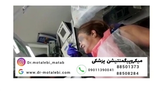 فیلم واقعی میکروپیگمنتیشن