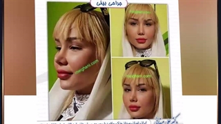 نمونه کارهای دکتر میقانی