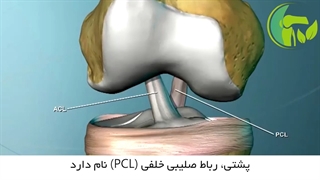 انیمیشنی از پارگى رباط صلیبى