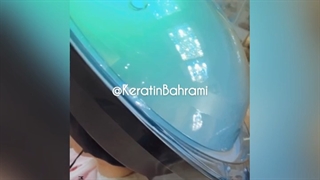 اسکراب اسکالپ