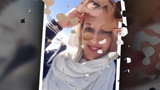 سه ماه بعد از عمل بیینی