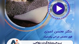 فیلم برجسته سازی صورت با کمک پروتز صورت