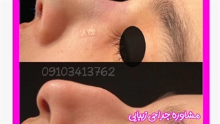 جراح زیبایی بینی در مشهد