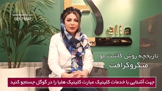 مستند کاشت مو به روش میکروگرافت ( تاریخچه ) - قسمت دوم