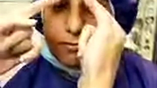 عمل رینوپلاستی