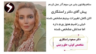 عمل بینی بعد از 6 ماه
