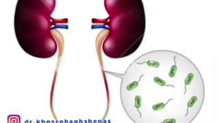 عفونت مجاری ادراری