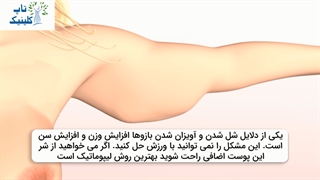 چگونگی انجام عمل لیپوماتیک بازو