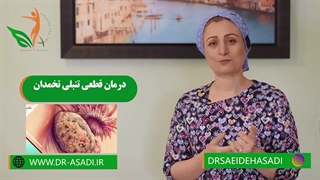 درمان قطعی تنبلی تخمدان