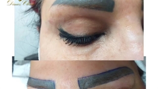 کاشت ابرو حرفه ای