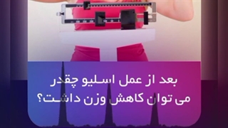 بعد از عمل اسلیو چقدر می توان کاهش وزن داشت؟