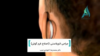 جراحی زیبایی گوش