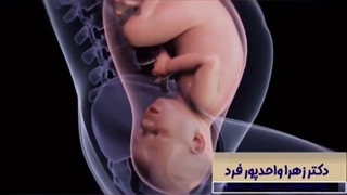 نحوه به دنیا آمدن نوزاد در زایمان طبیعی