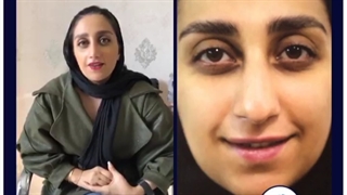 معجزه جراحی زیبایی بینی