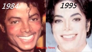 مایکل جکسون چند عمل زیبایی داشت...باتصاویر...به چشمانتان اعتماد کنید...