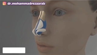 این ویدیو جراحى زیبایى بینى را به خوبی نشان می دهد