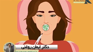 تزریق ژل لب ترمیم ونیر