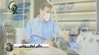 میکرودرم ابریژن چه مزیت هایی دارد ؟ دندان شیری