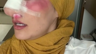 دماغ خوشگلا