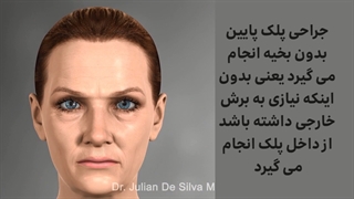 جراحی پلک پایین بدون بخیه