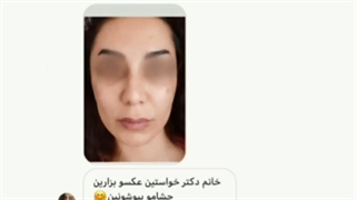 رضایت زیباجو از تخلیه ژل بیوپلیمر