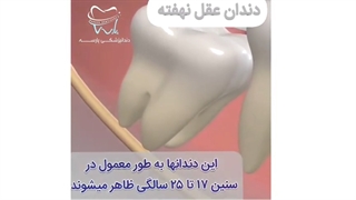 انیمیشن دندان عقل نهفته