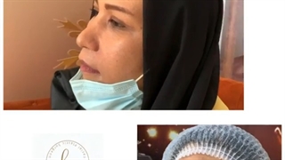 فیلم جراحی پلک آسیایی