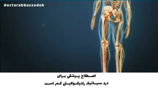سیاتیک و دیسک کمر