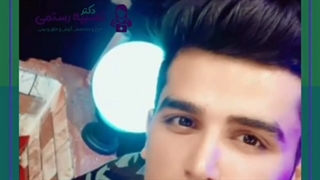 نمونه جراحی بینی یکسال بعد از عمل