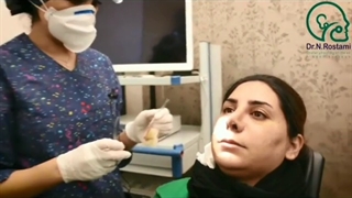 نمونه عمل بینی از دکتر نصیبه رستمی