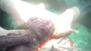 لحظه به دنیا آمدن بچه | دکتر لیلا مقاره عابد متخصص زنان