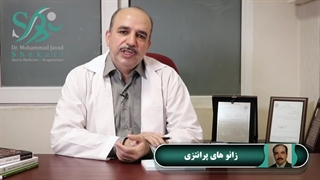 زانوهای پرانتزی